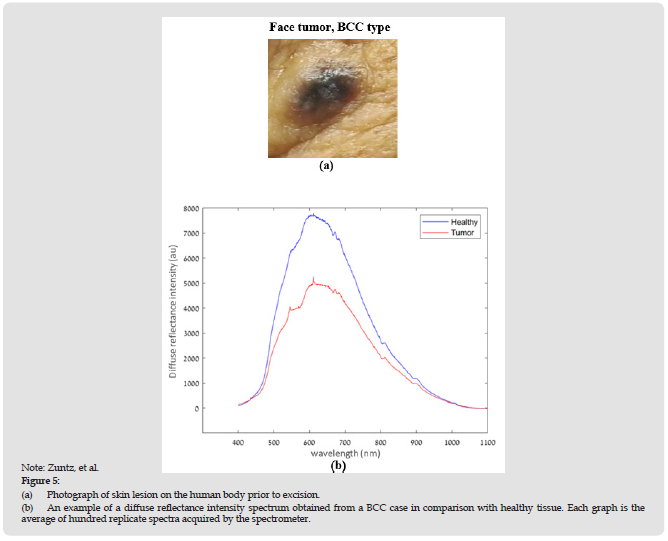 Click here to view Large Figure 5 biomedres-openaccess-journal-bjstr