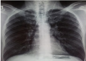 figure1