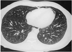 figure1
