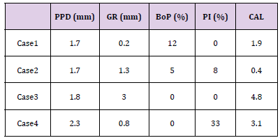 Click here to view Large Table 1 biomedres-openaccess-journal-bjstr
