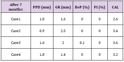 Click here to view Large Table 2 biomedres-openaccess-journal-bjstr